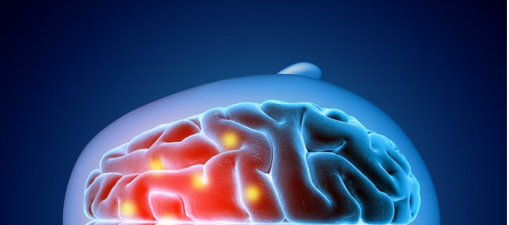 Adams解释昏迷病因分类