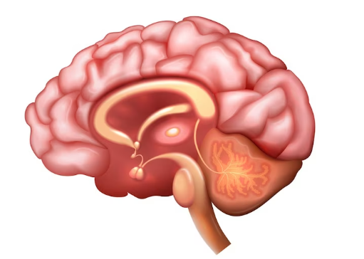 昏迷原因：幕下占位性病变有哪些情况
